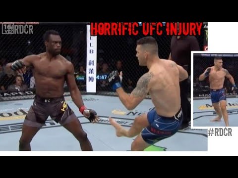 Horrific Ufc Accident Chris Weidman s Leg Shatters Vs Uriah
