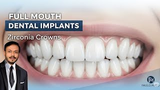 Full Mouth implant case with Paulo Malo zirconia crowns 