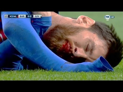 LE JOUR OÙ LIONEL MESSI A FAILLI MOURIR