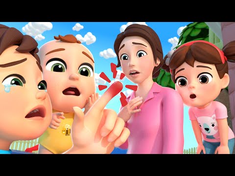 Boo Boo  Bugs Song (Insect Version) + MORE Baby Nursery Rhymes & Kids Songs