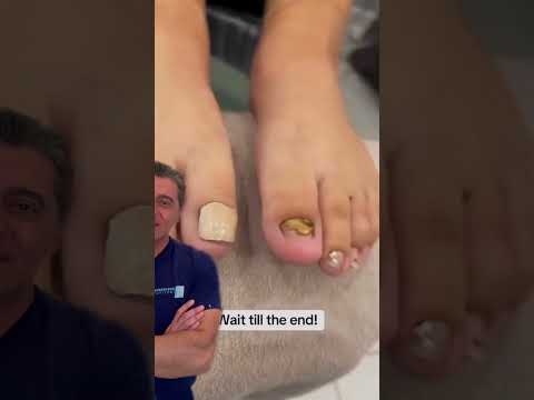 Why You Should Never Use a Wirecutter on Your Nails