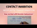 Contact Inhibition and Cancer Cells