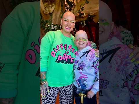 Her first time bald in public! So proud of my brave girly! 💗 #alopecia #alopeciaawareness #hairloss