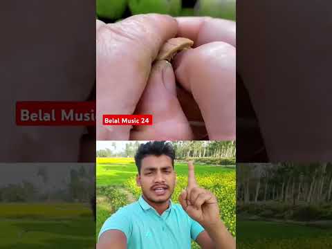 এটাই সেই গন্ধম ফল #Sandalwood fruit #viralvideo #reels #duet #video #viralshorts #vtuber #viralshort