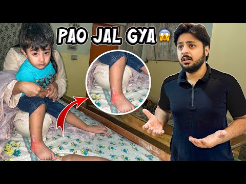 ZOHAN KA PAON JAL GYA 😨 | Iqra Ko Bht Miss Kea 🥹