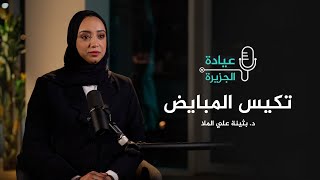 عيادة الجزيرة - في أي عمر تظهر متلازمة تكيس المبايض؟