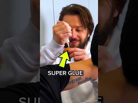 We superglued an egg to his head… 🥚🤣