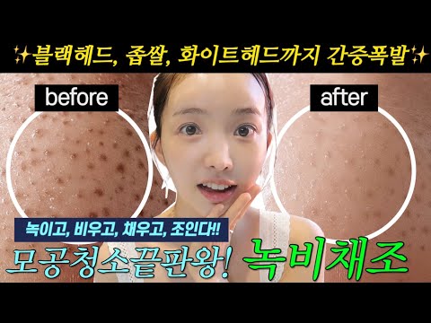 수백만원 아껴주는 효과쩌는 홈케어. 모공싹! 블랙헤드 쫙빼는 4단계 루틴