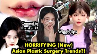 Asian plastic surgeries are getting OUT OF CONTROL...