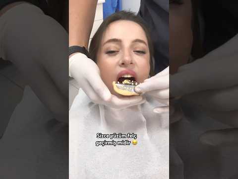 Dişimi yediğimi hatırlayan çıkar mı 😂 Heh onu yaptırmaya geldim #merveeben reklamyok