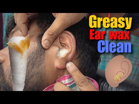 Greasy Ear Wax removed with Hp solution & power Head Massage by Great Shamboo Barber Asmr Ear Clean