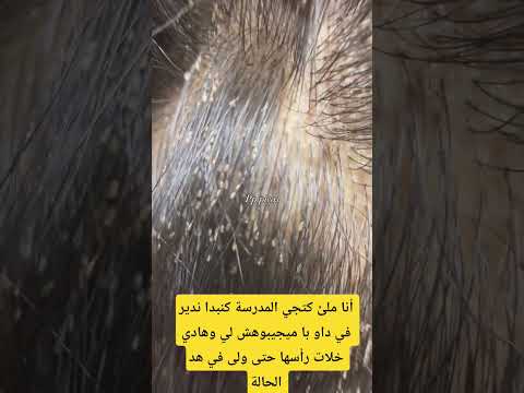 غي شوفو في هد المنظر عظامك يضروك #المغرب #اكسبلور