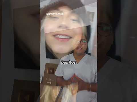 CHAU BRACKETS #dientes #dentista #tips #parati #viral #fyp #shorts #shortvideo #fypシ