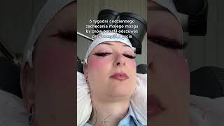 TMS pomógł mi na powrót odzyskać radość i chęć do życia