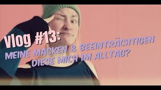 Vlog #13: Macken & Ticks | Was sind meine Macken und beeinträchtigen sie mich im Alltag?