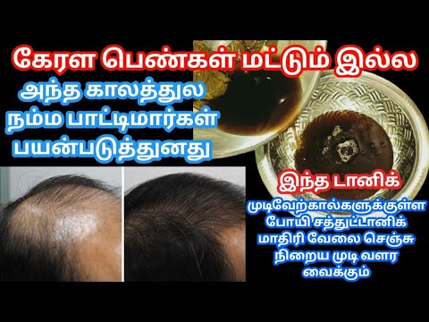 🔥🔥உதிர்ந்து போன உங்க முடி மறுபிறவி எடுக்க வைக்கும் tonic / fast hair growth in tamil