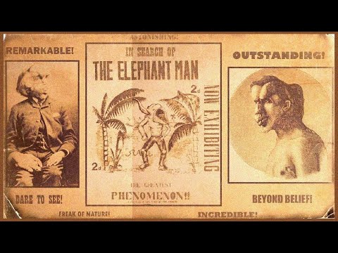 In Search Of The Elephant Man ... With Leonard Nimoy (1981). Superb Show Depicting John Merrick.