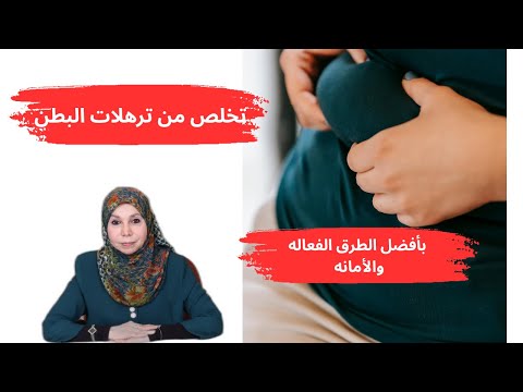 تخلص من ترهلات البطن بأفضل الطرق الفعاله والأمانه