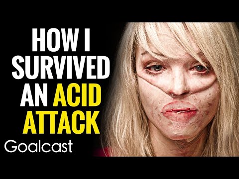 My Facebook Stalker Threw Acid In My Face | Katie Piper | Goalcast