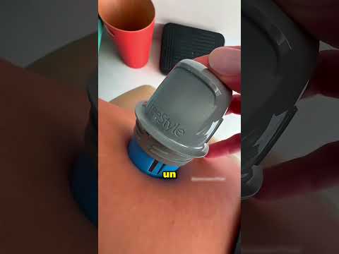 Questo ragazzo ha strappato il dispositivo per il diabete della sua amica 😱