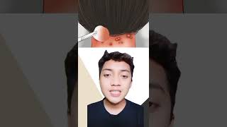 KUMPULAN REACTION ASMR BIKIN NGILU‼️😨 | kompilasi short video abew stwn