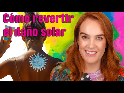 Cómo revertir el daño solar.