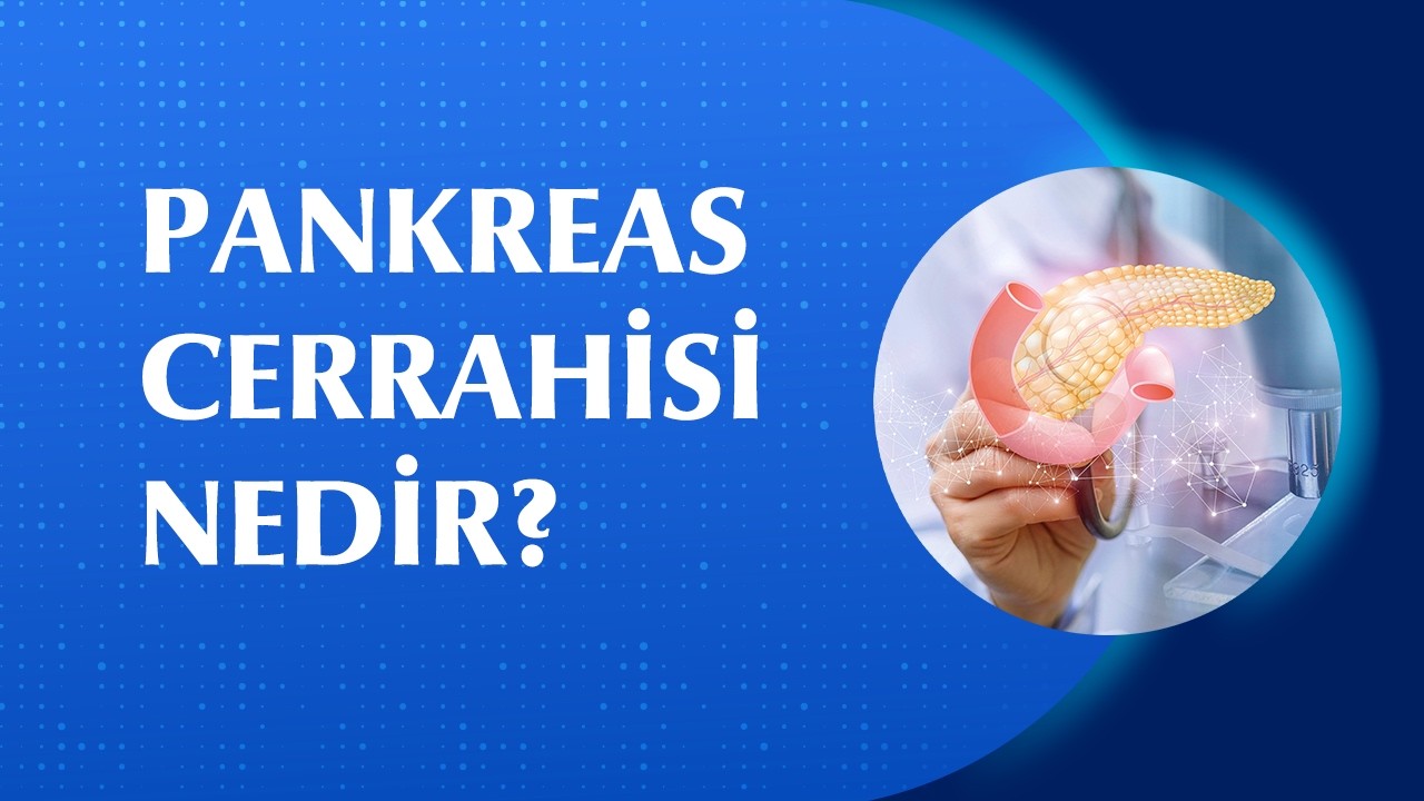 Sarılık, Karın Ağrısı ve Kilo Kaybı Pankreas Kanserinin Habercisi Olabilir mi?
