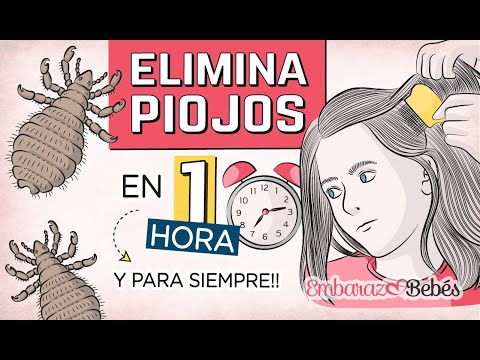 💇🏻♀️🔥 3 Remedios para ELIMINAR PIOJOS y Liendres en 1 HORA y para Siempre!!!