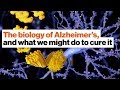 Understanding Alzheimer's Disease