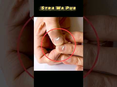 শরীরে এগুলো দেখা দিলেই সাবধান হয়ে যান । Body signs you shouldn't ignore ।  Stra Wa Pub #shorts