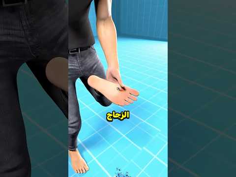 ماذا تفعل إذا علقت قطعة زجاج في قدميك😳!؟