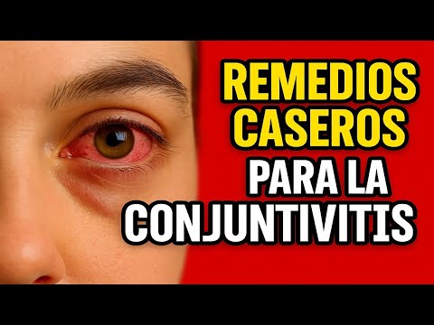 Remedios Caseros para la CONJUNTIVITIS Curar Rapido Tratamiento Natural 2025