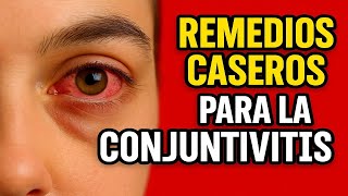 Remedios Caseros para la CONJUNTIVITIS Curar Rapido Tratamiento Natural 2025