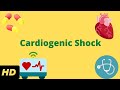 Cardiogenic Shock Diagnosis and Treatment