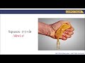 Understanding the Concept of 'Squeeze'