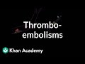Understanding Arterial Blockages and Terminology