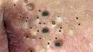 حلول طبيعية لبشرة صافية#𝐋𝐍𝐆