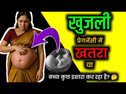 "Pregnancy में पेट की खुजली – खतरा है या Baby कुछ Signal दे रहा है? जानिए सच!" Itching In Pregnancy