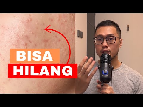 Skincare Rutin untuk beruntusan