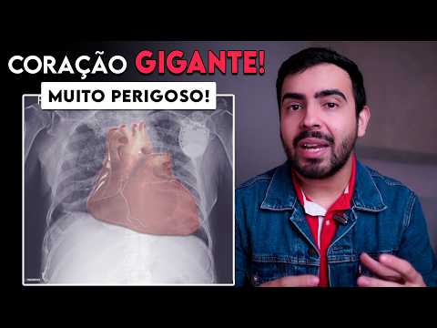 Como saber se o CORAÇÃO está GRANDE? - SINAIS DE CORAÇÃO GRANDE (cardiomegalia)