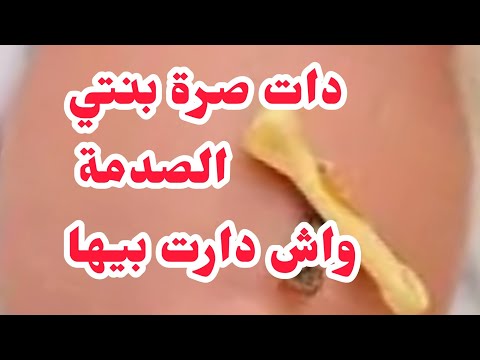 دات صرة بنتي❌في يوم السابع بخرتلي بنتي فوق كسرونة❤️‍🩹والصدمة واش دارت بيها انتقا ما مني