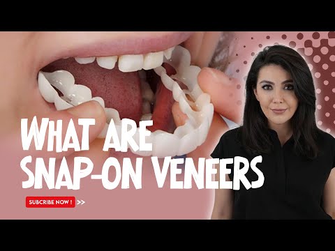 Snap On Veneers