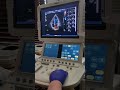 Cardiac Imaging and Measurement Concepts
