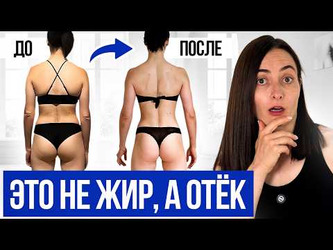 Ты не толстая, а отекшая! Как я перестала отекать? 5 моих СЕКРЕТОВ