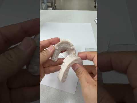 Before and After Wax-Up #lsk121shorts #dentist #teeth