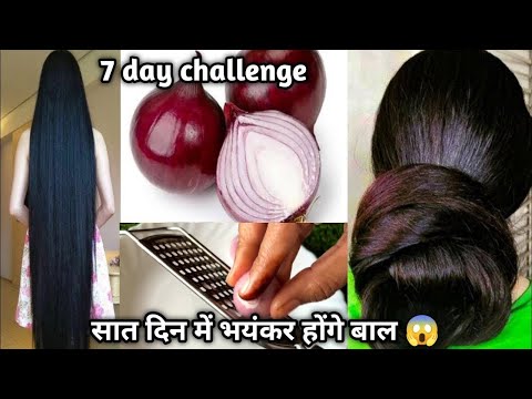 कसम से बस एक बार लगा कर देखो बालों की लंबाई इतनी बढ़ेगी की बस कटवाते रह जाओगे😱super fast hair growth