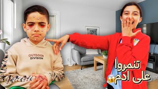 تنمرو على ادم بسبب عينو😭 شوفو ردة فعل تالين 😱