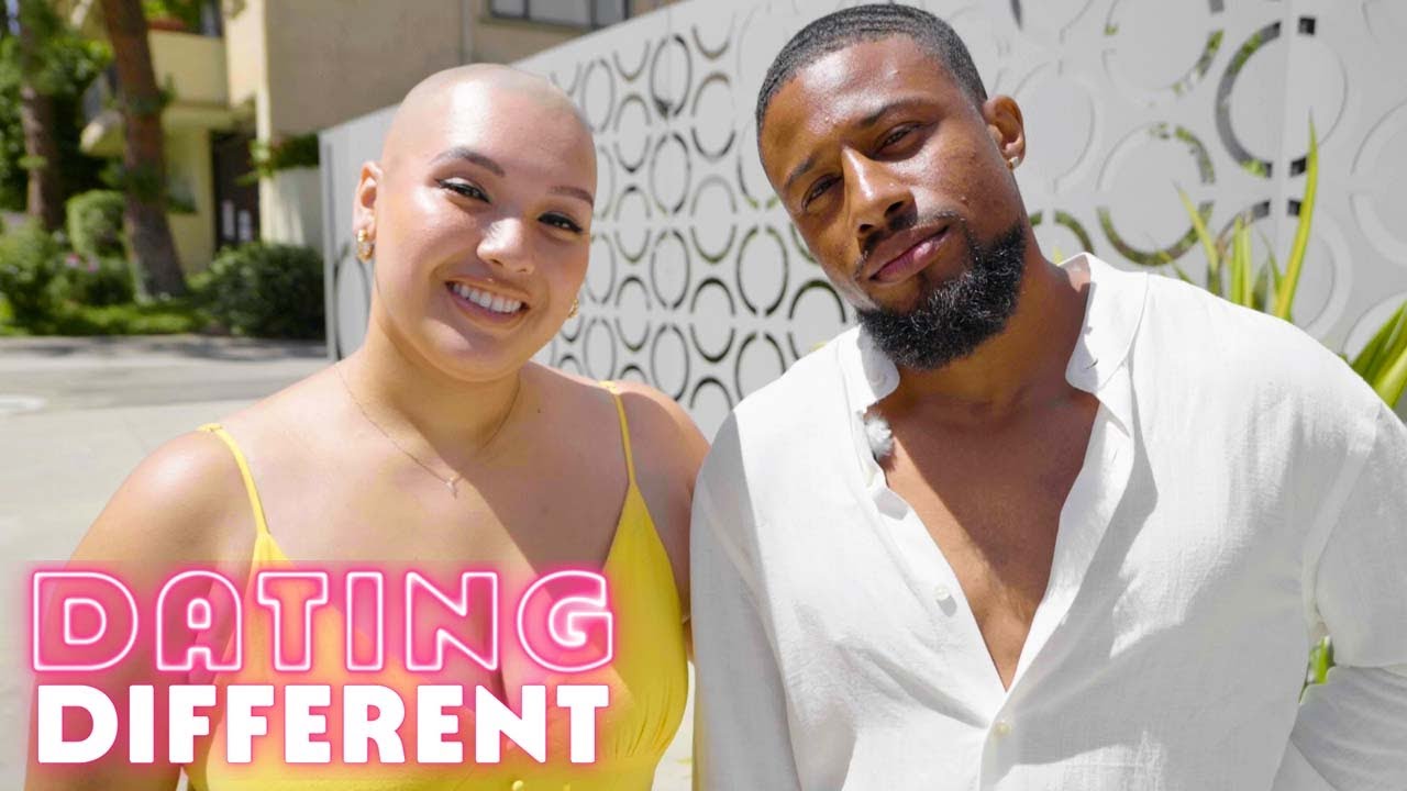 I used to hide my bald head - now i'm ready to date - dating different