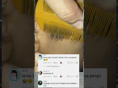 sisir #shorts