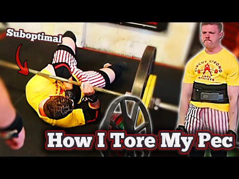How I Tore My Pec! - A Meme Experience